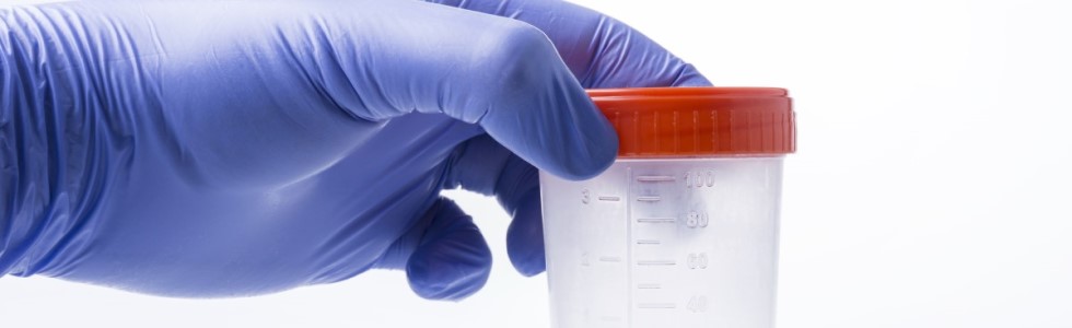 Ein Urinbecher mit orangenem Deckel wird von einer Hand mit Handschuhen erhalten