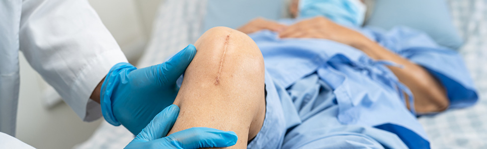Ein Arzt positioniert das Knie einer Seniorin auf einem Arthrodesenkissen
