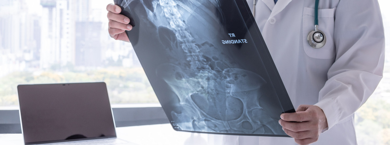 Ein Arzt betrachtet ein Röntgenbild vom Magen, für das Kontrastmittel verwendet wurde