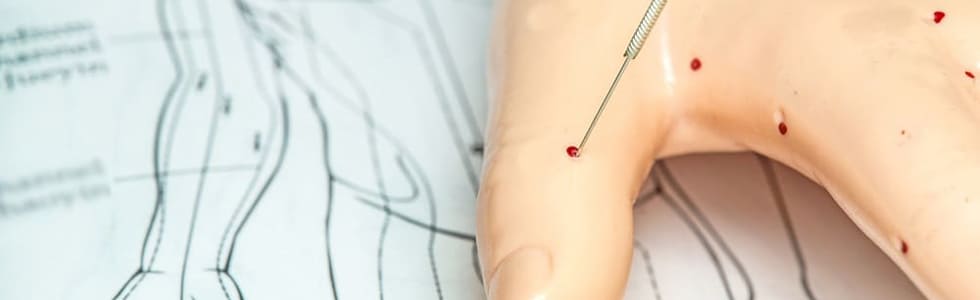 Anatomisches Modell einer Hand mit Akupunkturpunkten