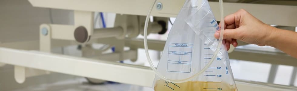 Krankenschwester wechselt einen vollen Urinbeutel aus