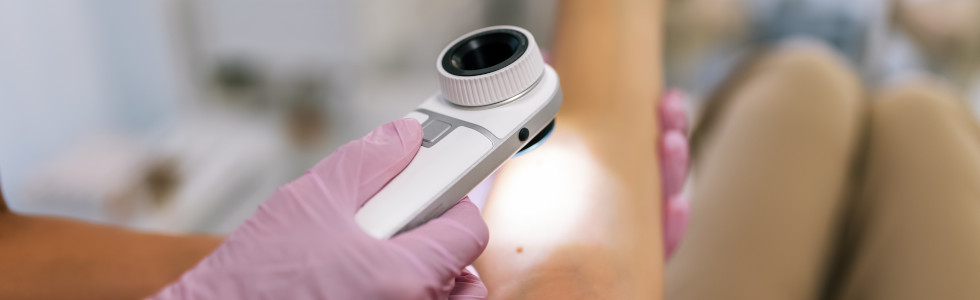 Ärztin untersucht Muttermal auf Arm mit Dermatoskop — jetzt Dermatoskop kaufen!