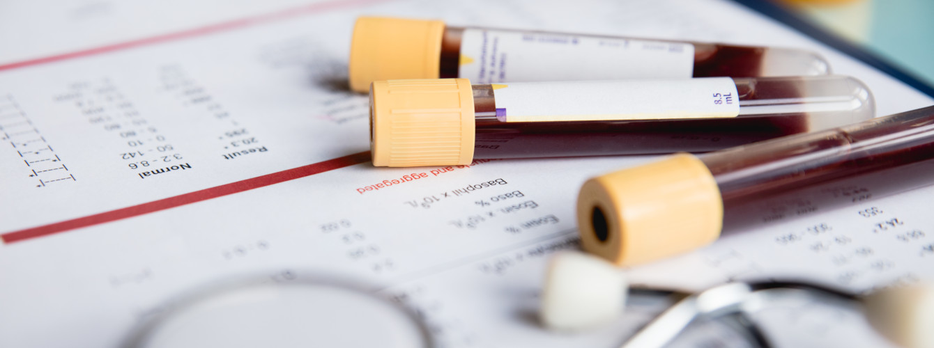 Zwei Proben auf dem Tisch – der Blutspiegel soll geprüft werden