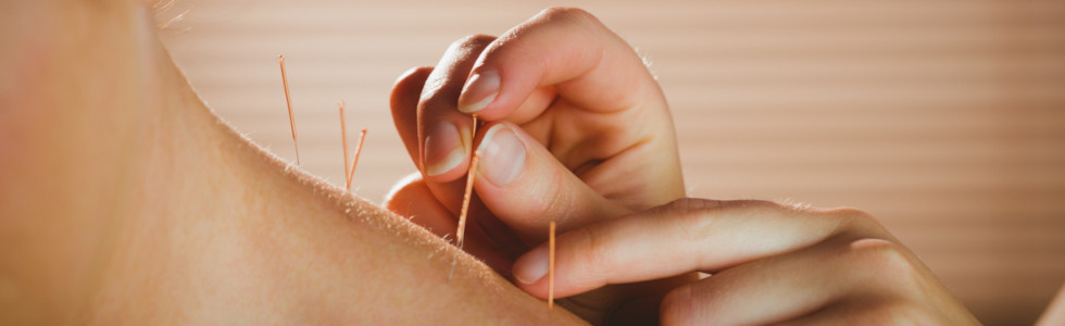 Eine Frau nutzt Akupunktur